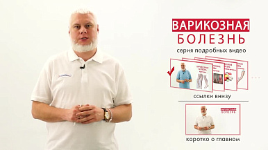 Варикоз и его причины