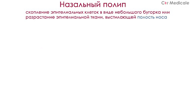 Полипы носа