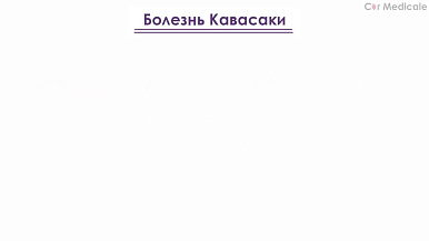 Болезнь Кавасаки