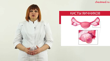 Киста яичника. Лечить? Или сама исчезнет?